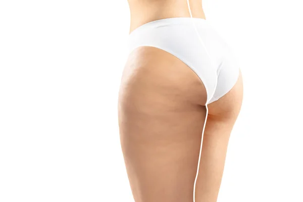 Mujer con sobrepeso, piernas y nalgas de celulitis grasa, obesidad cuerpo femenino en ropa interior blanca en comparación con el ajuste y el cuerpo delgado aislado sobre fondo blanco — Foto de Stock