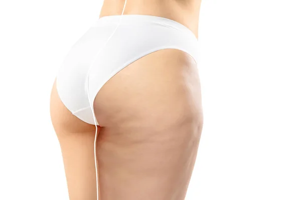 Kobieta z nadwagą z grubymi nogami i pośladkami cellulitu, otyłość ciało kobiety w białej bieliźnie w porównaniu z dopasowaniem i cienkie ciało izolowane na białym tle — Zdjęcie stockowe