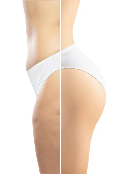 Donna sovrappeso con grasso cellulite gambe e glutei, obesità corpo femminile in biancheria intima bianca a confronto con in forma e corpo sottile isolato su sfondo bianco — Foto Stock