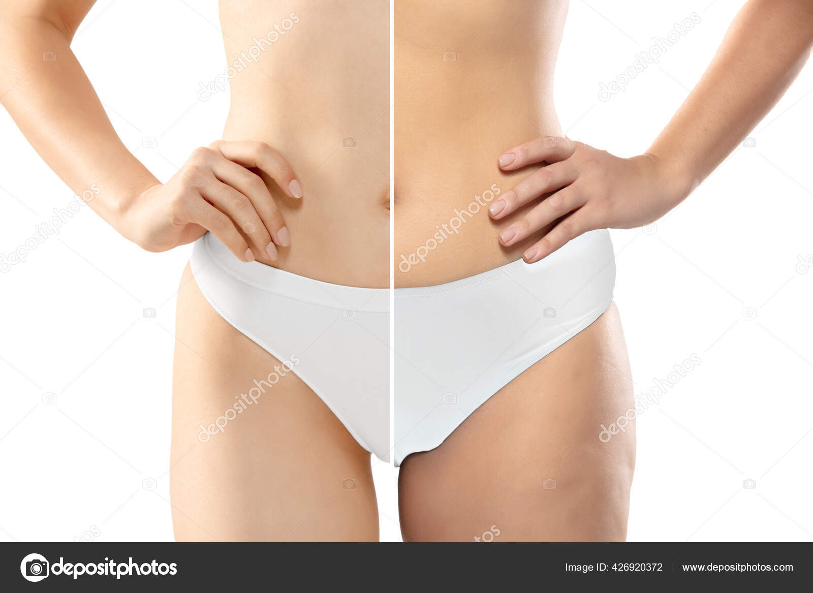 Overweight woman with fat cellulite legs and belly, obesity female