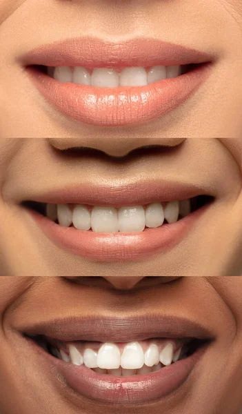 Weibliche Lippen in Großaufnahme. Vertikale Collage. Nackt-Make-up. Kosmetologie, Hautpflegekonzept. Werbeflyer. — Stockfoto