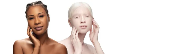 Retrato de bela mulher albina e mulher afro-americana isolada em fundo de estúdio branco. Skincare, conceito de cosméticos. — Fotografia de Stock
