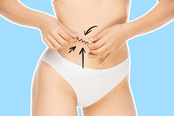 Corps féminin, ventre avec des flèches de dessin. Perte de graisse, liposuccion et concept d'élimination de la cellulite. Bon et rapide problème métabolique. — Photo