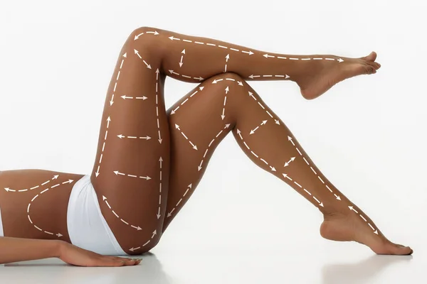 Markierungen an Hüfte, Taille und Beinen der Frau vor einer Schönheitsoperation. Kaukasische junge fitte Frau als Vorbild — Stockfoto