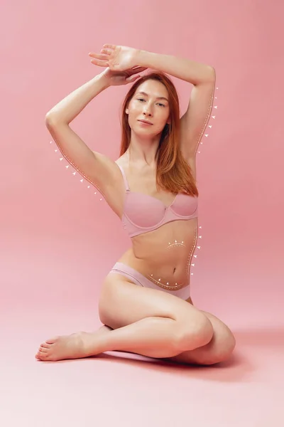 Märken eller pilar på kvinnors höfter och mage före plastikkirurgi. Lyft, skönhet, kroppsvård, celluliter och hälsosam livsstil koncept. — Stockfoto
