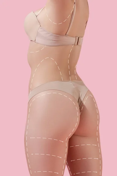 Primer plano hermoso cuerpo femenino, nalgas con levantamiento de flechas aisladas sobre fondo rosa. Collage. Piel resistente, cuerpo de fitness, procedimientos contra la celulitis. —  Fotos de Stock