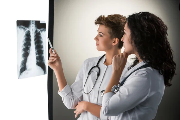 Двоє привабливих молодих лікарів дивляться на результати рентгенівського випромінювання — стокове фото