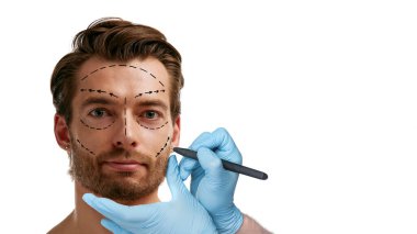 Ameliyattan önce eldivenli ellerle işaretlenmiş ameliyat çizgileri olan bir adam yüzü. Estetik tıp, estetik cerrahi, yüz düzeltme ve erkek cilt bakımı. Kolaj