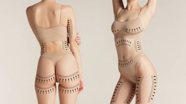 Kolaj sanatı. Oklu kadın vücudu yön ve düzeltme bölgelerini gösteriyor. Vücut hatları, kozmetik tedavi planı, yağ aldırma gelişimi ve estetik tıp görselleri kavramı.