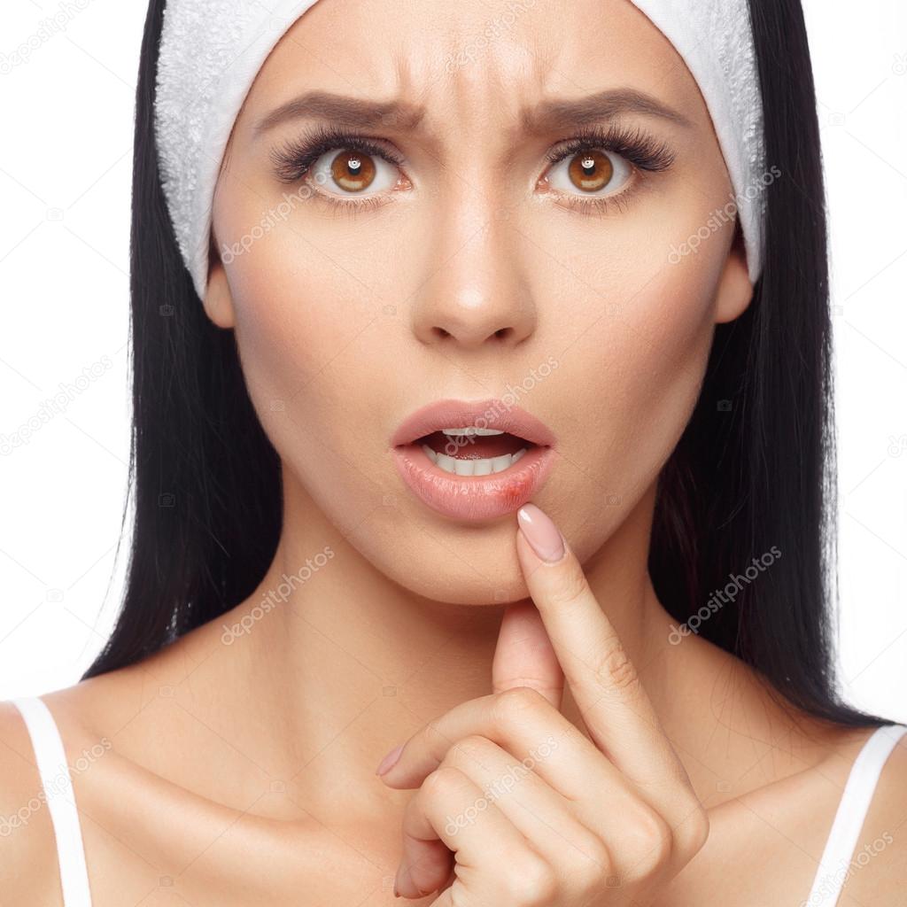 Herpes Auf Den Lippen Der Jungen Frau Stockfoto C Lyashik 123479878