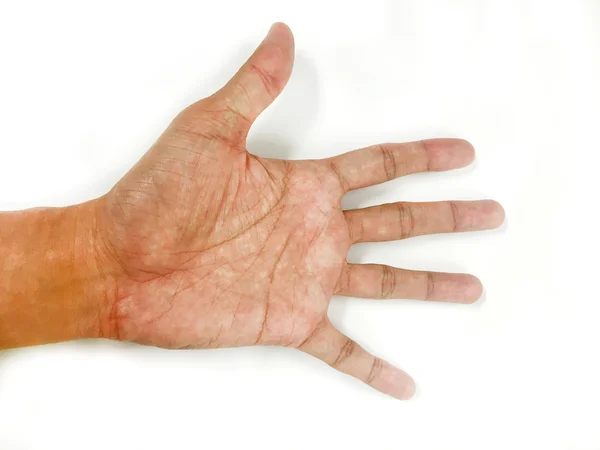 Open the palm of the hands — Stock Photo, Image