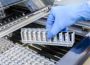 Laboratuvar asistanı sıvıyı analiz eder, eldiven verir. Kasetteki tüpler..