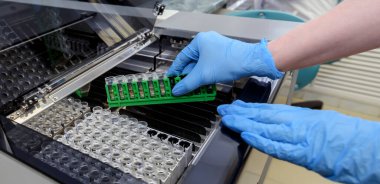 Laboratuvar asistanı sıvıyı analiz eder, eldiven verir. Kasetteki tüpler..