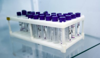 Laboratory. Test tubes in a stand on a table for analyzing samples for caronavirus.
