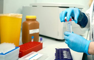 Genetik Biyoteknoloji Laboratuvarı. Test için hücre kültürlerinin analizi. Pediatrik Onkoloji Bilimsel ve Uygulama Merkezi.