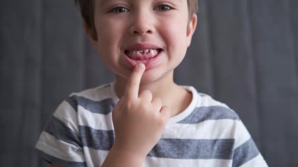 4k. pequeño caucásico chico mostrar dos primero falta leche dientes — Vídeos de Stock