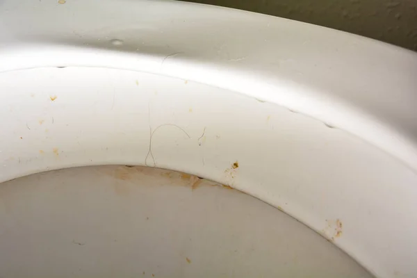 Vaso Sanitário Muito Sujo Com Urina Matéria Fecal — Fotografia de Stock