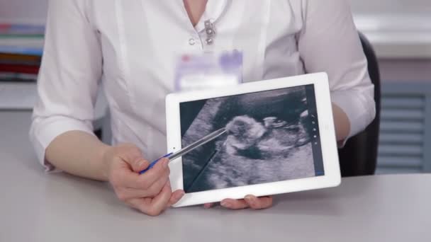 Médico usando comprimido para mostrar ultra-som para o paciente — Vídeo de Stock