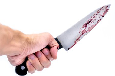 Elinde kan damlayan ile bir bıçak el