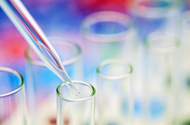 laboratuvar test tüpleri