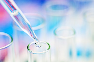 laboratuvar test tüpleri
