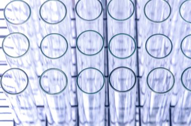 laboratuvar test tüpleri