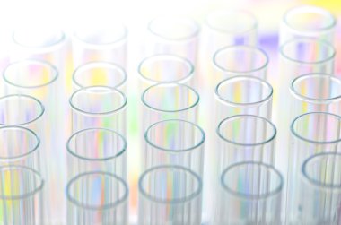 laboratuvar test tüpleri