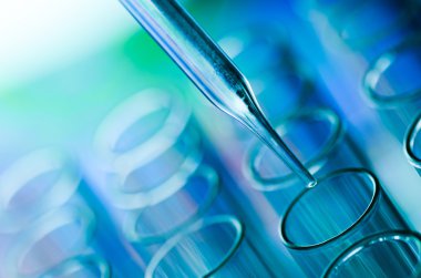 laboratuvar test tüpleri