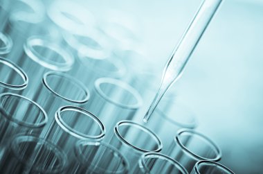 laboratuvar test tüpleri