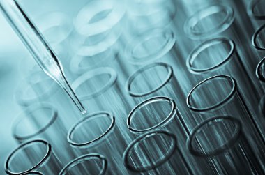 laboratuvar test tüpleri