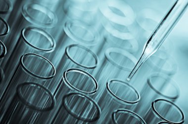 laboratuvar test tüpleri