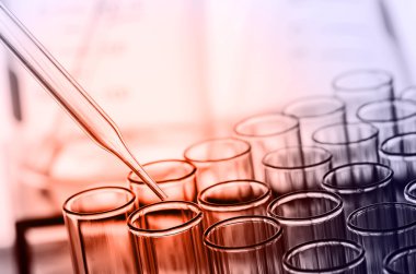 laboratuvar test tüpleri