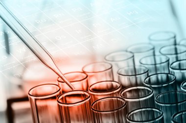 laboratuvar test tüpleri