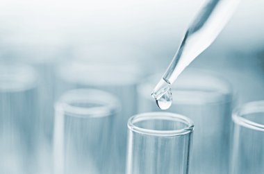 laboratuvar test tüpleri