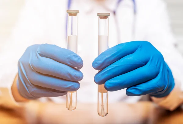 Mãos de médico masculino segurando dois tubos de ensaio em laboratório de perto — Fotografia de Stock