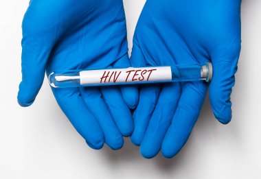 Doktorun elindeki kan analizinin HIV testi sonucunu içeren test tüpleri..