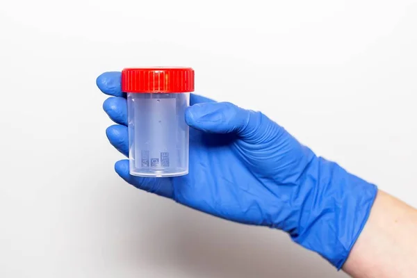 精子又は尿の分析のための瓶又は瓶又は容器を有する医師の手 — ストック写真
