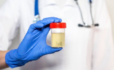 Muayene için idrar örneği ya da şişe ya da kavanozda analiz ya da doktor elinde konteyner..