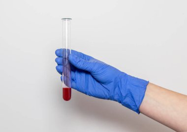 Analiz için test tüpündeki kan örneği doktorun ellerinde. Beyaz arka planda izole edilmiş bir şekilde kapat..
