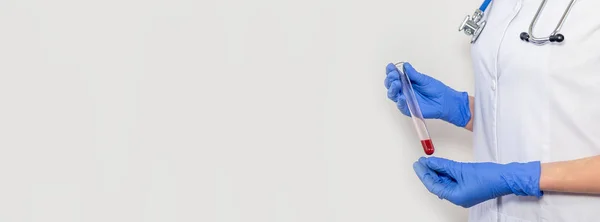 Vérminta Kémcsőben Elemzésre Orvosi Kezekben Elkülönítve Fehér Háttérrel Vízszintes Transzparens — Stock Fotó