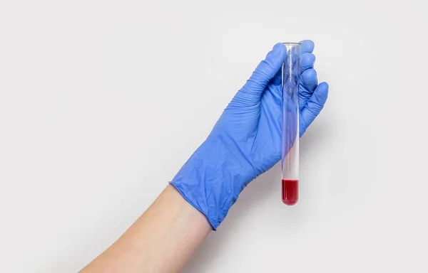 Vérminta Kémcsőben Orvosi Kézen Végzett Analízis Céljából Fehér Alapon Izolált — Stock Fotó