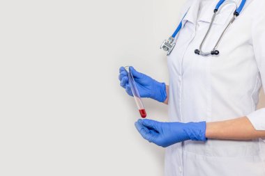 Analiz için test tüpündeki kan örneği doktorun ellerinde. Kapatın..