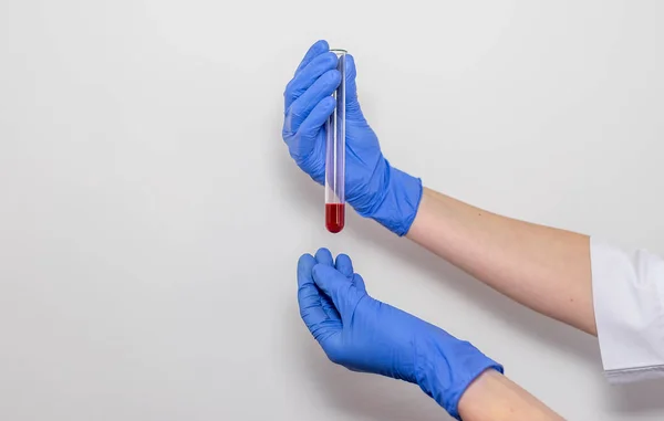 Amostra Sangue Tubo Ensaio Para Análise Mãos Médico Fechar Isolado — Fotografia de Stock