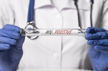 Doktorun elinde eldivenle HIV pozitif test.