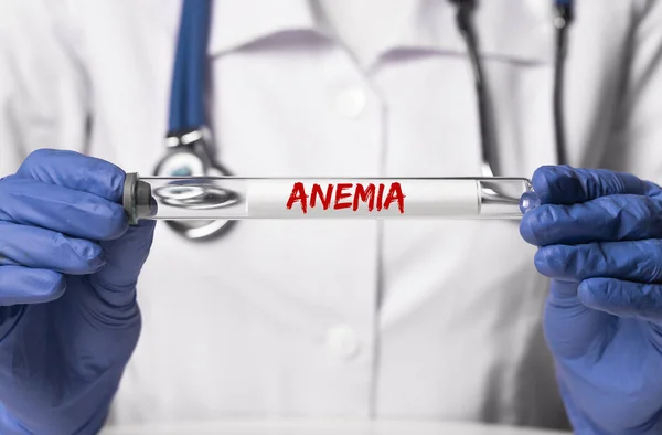 Parola di anemia sulla provetta di laboratorio di vetro in mano medico — Foto Stock