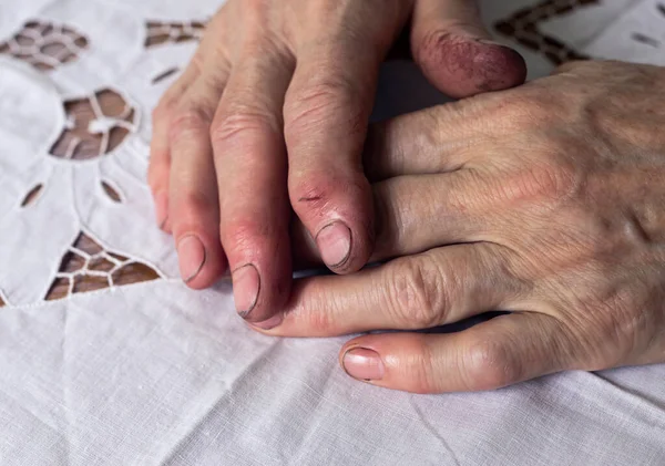 Working dirty hands of senior woman after work, lying on table, closeup — Φωτογραφία Αρχείου