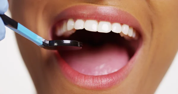 Close up de mulher negra sorridente no dentista — Fotografia de Stock