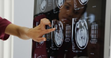 X-ışınları gözden Doktorlar beyin