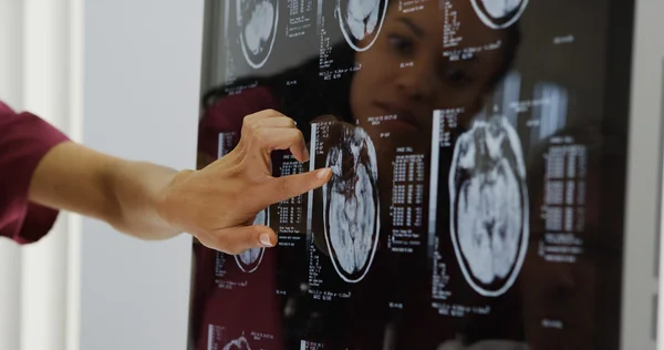 Doctors reviewing brain x-rays — Stock Photo, Image