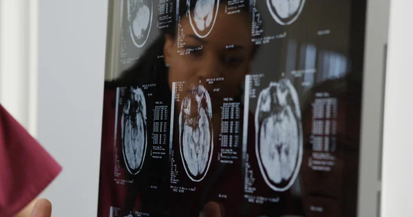 Médicos revisando rayos X cerebrales — Foto de Stock